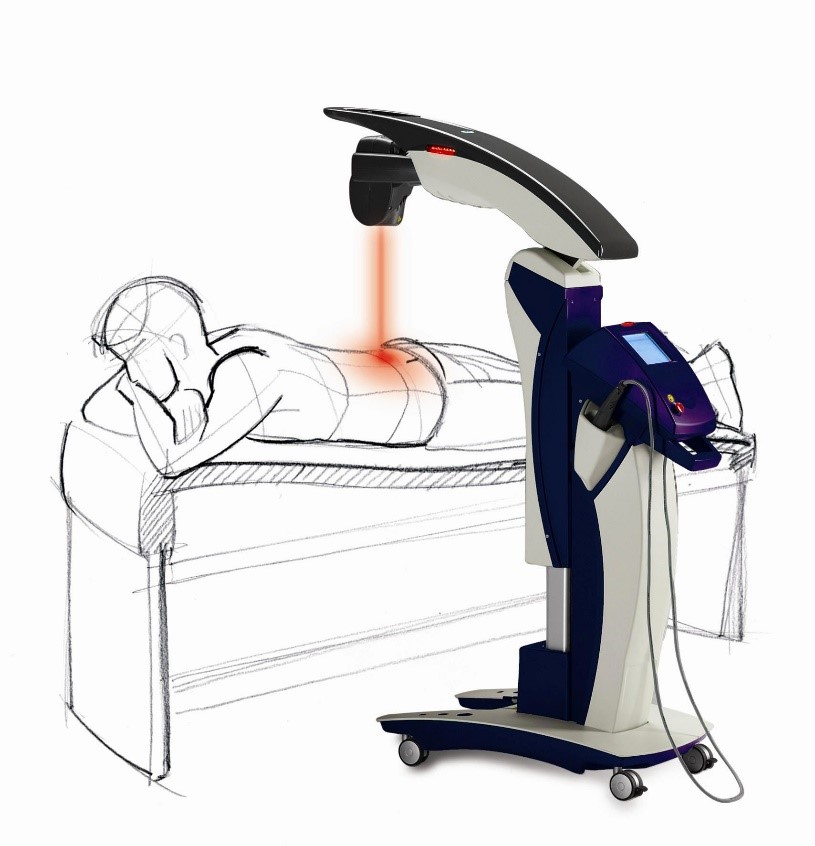لیزر و لیزر پرتوان چیست و چه تاثیری در درمان آسیب دیدگی عضلات دارد؟ - فیزیوتراپی پردیس